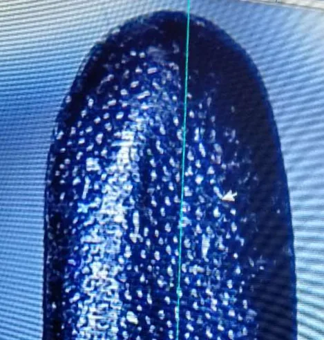 Magnified ceramic RF-NonStick surface on an electrosurgical electrode