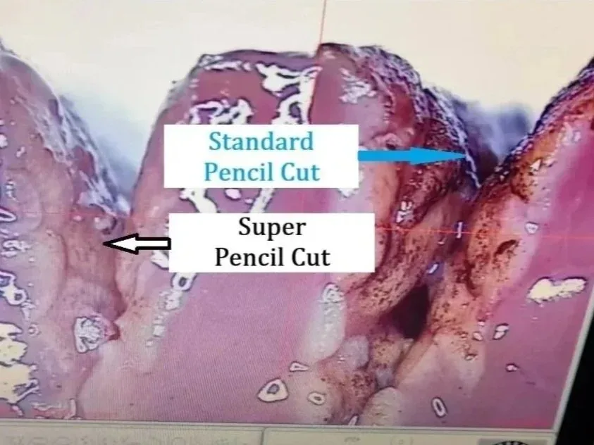 Histology of pig liver tissue comparing a Super Pencil cut with a standard pencil cut