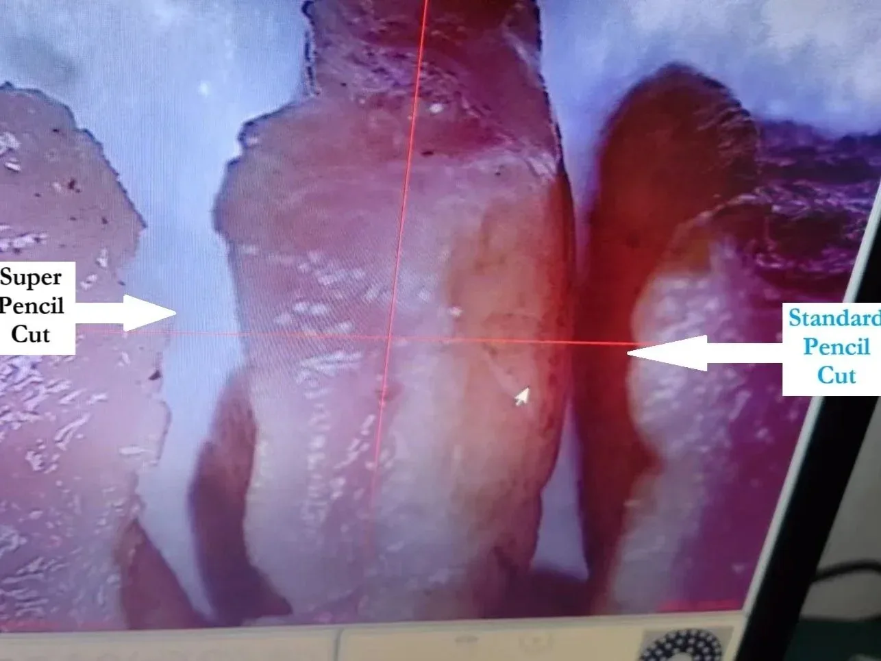 Histology of pig muscle tissue comparing a Super Pencil cut with a standard pencil cut